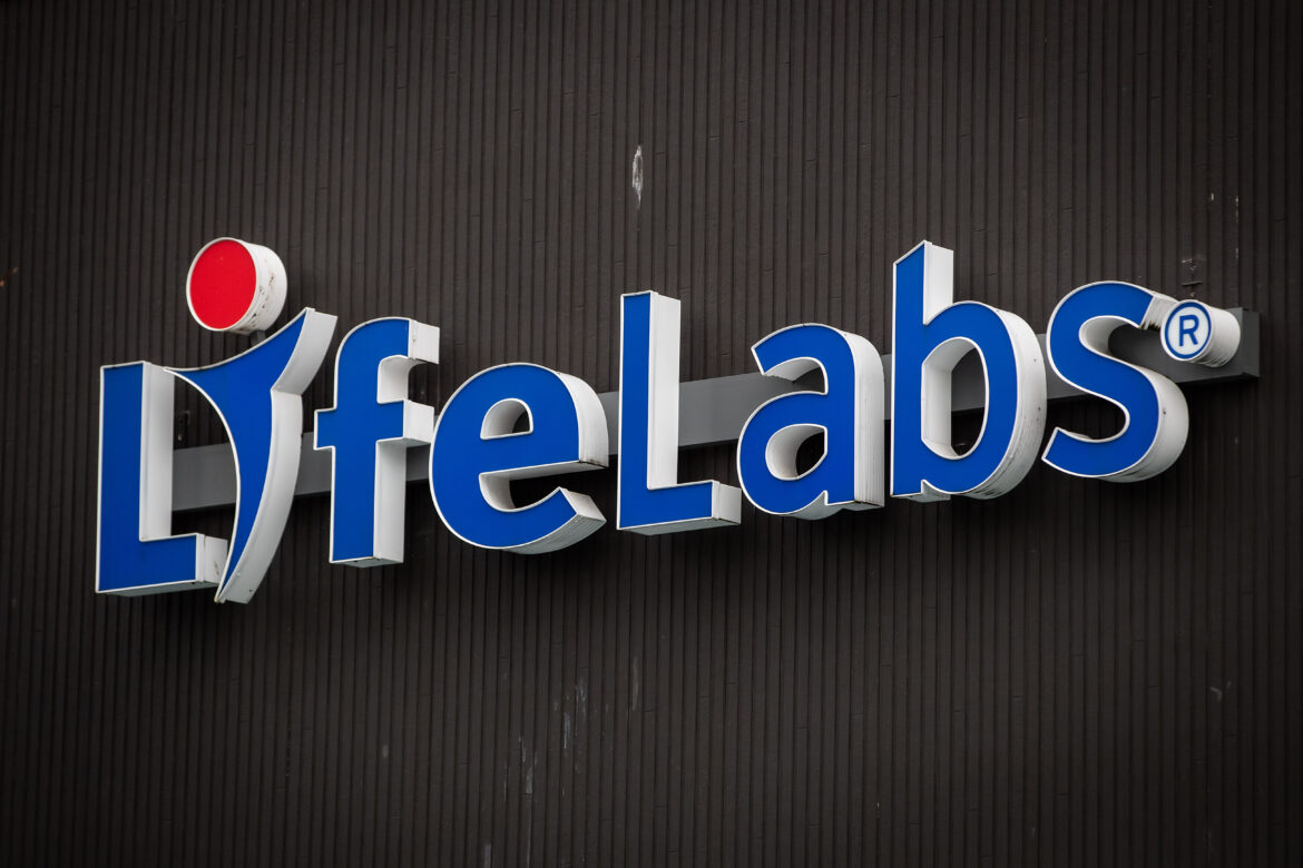 Lifelabs-Job-Action 20250217