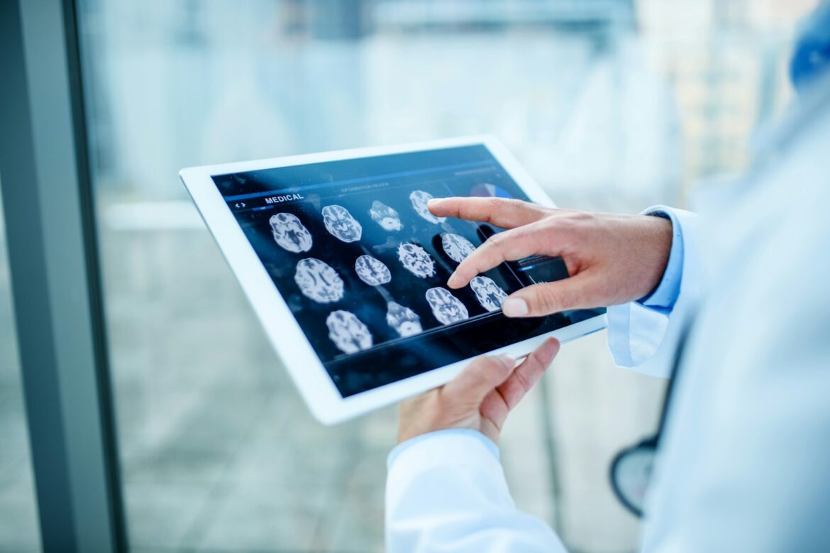 Doctor looking at a tablet with imaging results