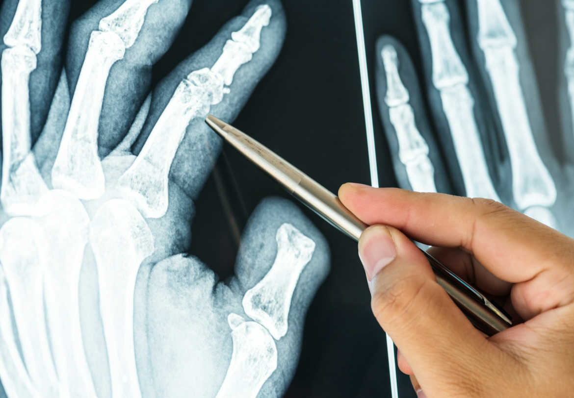 Xray